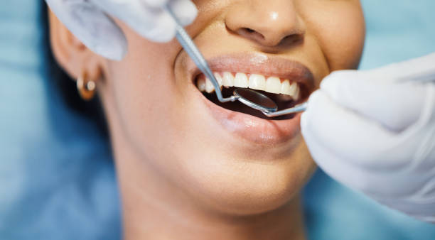 Best Emergency Wisdom Teeth Removal in Ridgecrest, CA