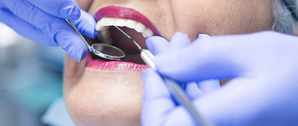 Best Urgent Care for Lost Fillings or Crowns in Ridgecrest, CA